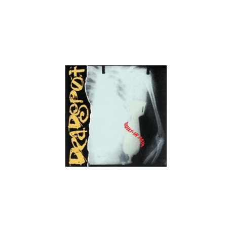 Deadspot-Built-In Pain