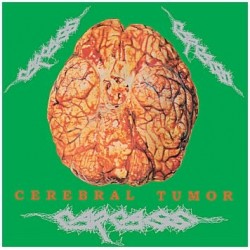 Carcass-Cerebral Tumor (Live in Dortmund, Germany, 30/07/90)