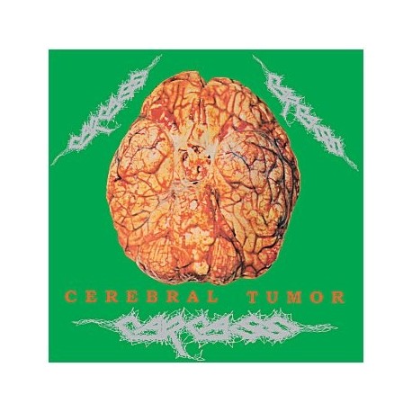 Carcass-Cerebral Tumor (Live in Dortmund, Germany, 30/07/90)